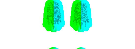 LASER VOLT 無料立ち読み301